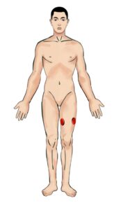 Frattura delle ossa - Untitled design 14